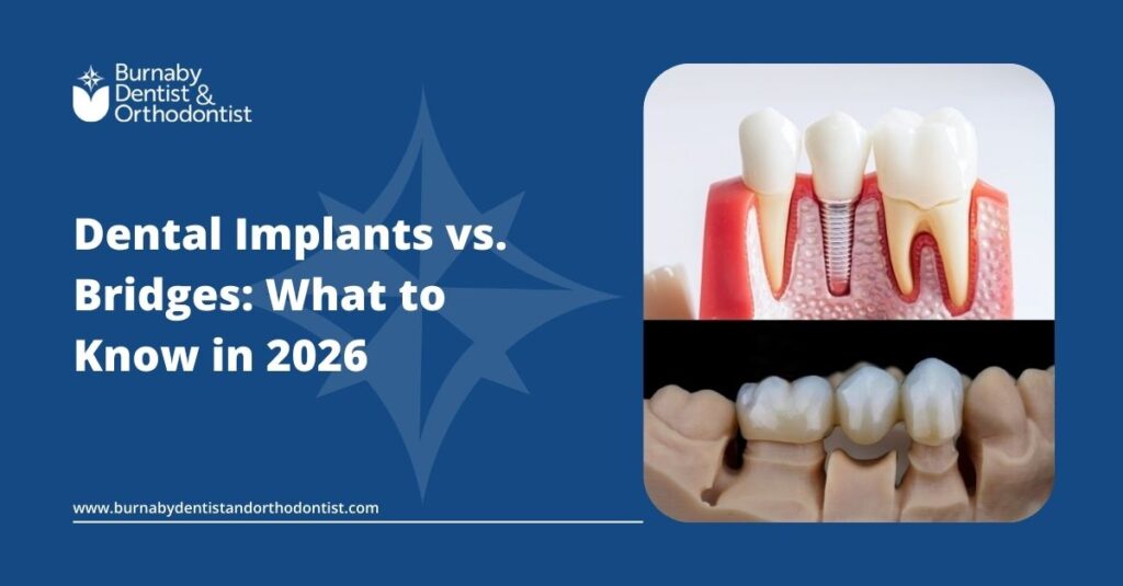 Implants or Bridges? Your 2026 Tooth Replacement Guide