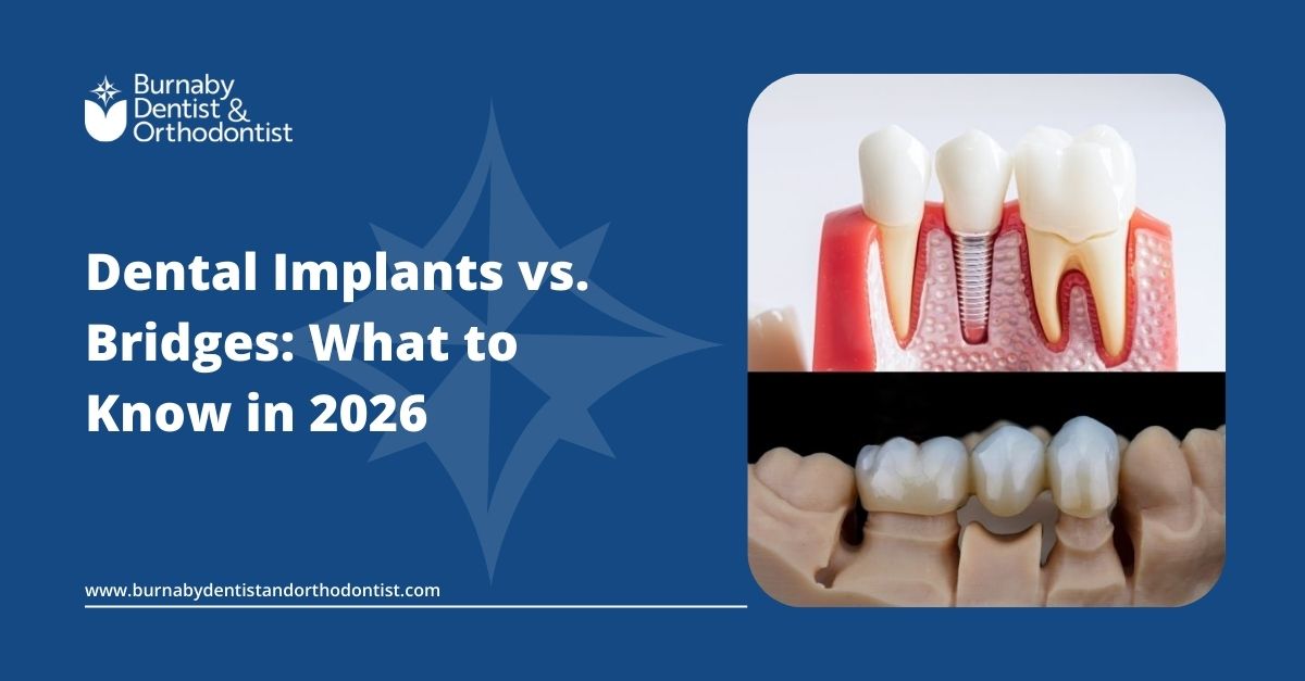 Implants or Bridges? Your 2026 Tooth Replacement Guide