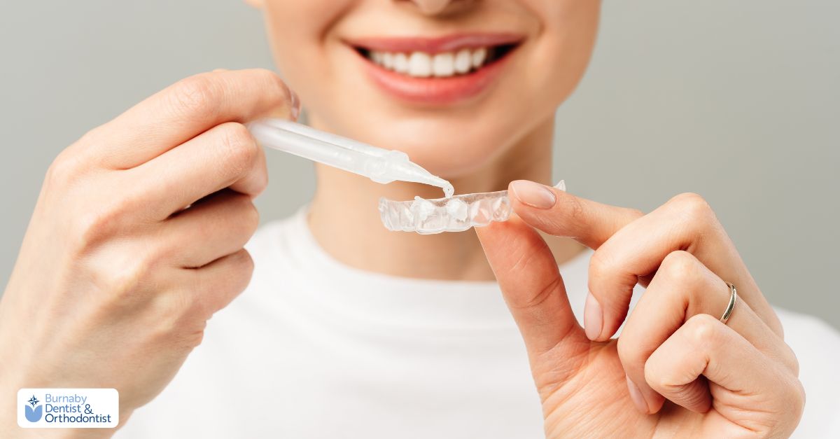  A patient applying dentist-provided whitening trays for gradual enamel-safe whitening