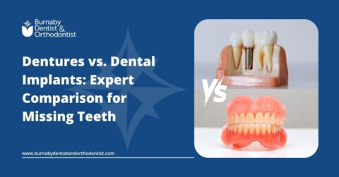 Dentures vs. Dental Implants: Expert Comparison for Missing Teeth