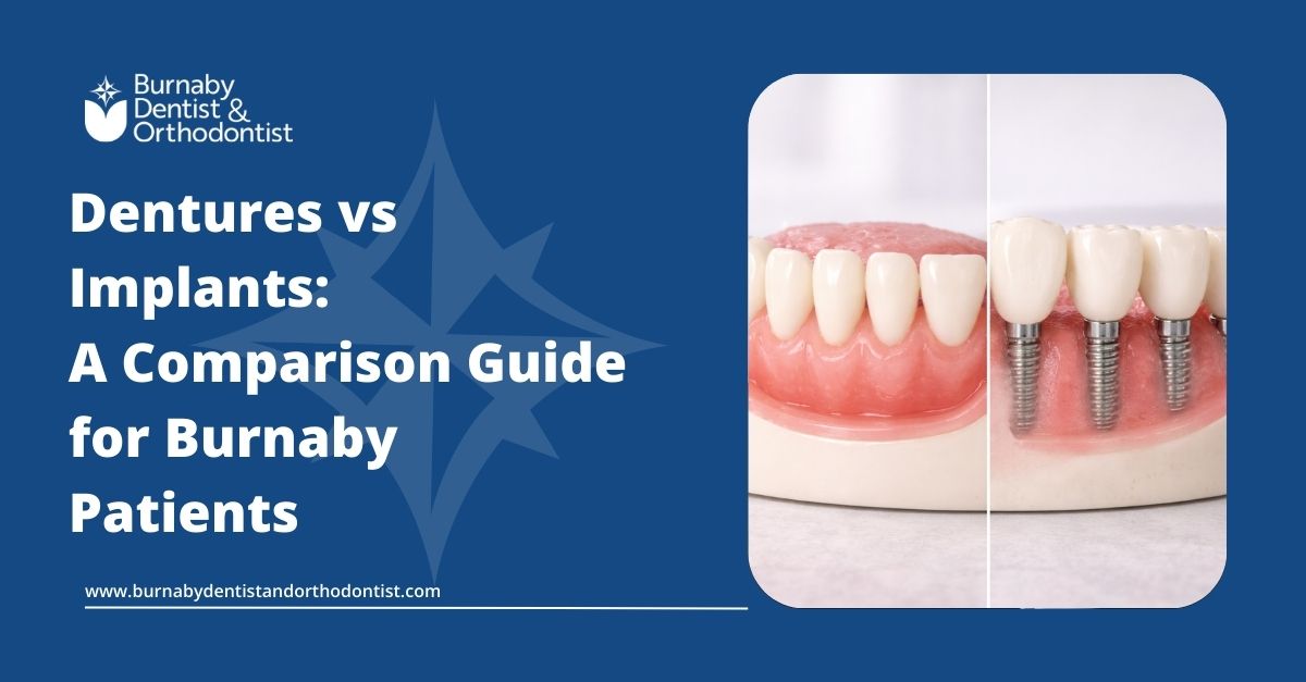 Dentures vs. Dental Implants: Comparison for Missing Teeth