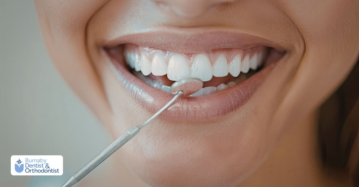 Detailed view of veneers during oral examination for dental veneers care.