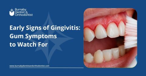 Close-up of inflamed gums showing early signs of gingivitis, including redness, swelling, and bleeding near the gumline during brushing.