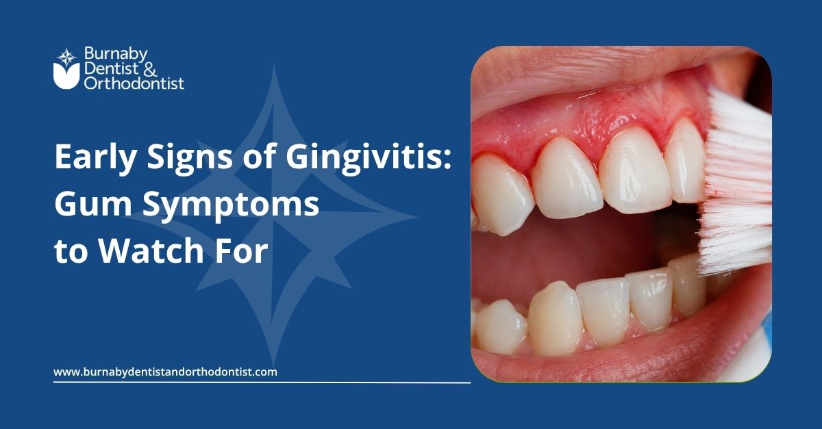 Close-up of inflamed gums showing early signs of gingivitis, including redness, swelling, and bleeding near the gumline during brushing.