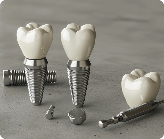 Cost of Dental Implants in Burnaby: What to Expect