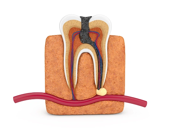 Signs and Symptoms of Tooth Infection