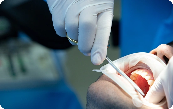 Pain Management and Comfort During Root Canal Therapy
