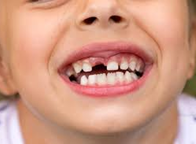 Help Me With Tooth Pain or an Emergency