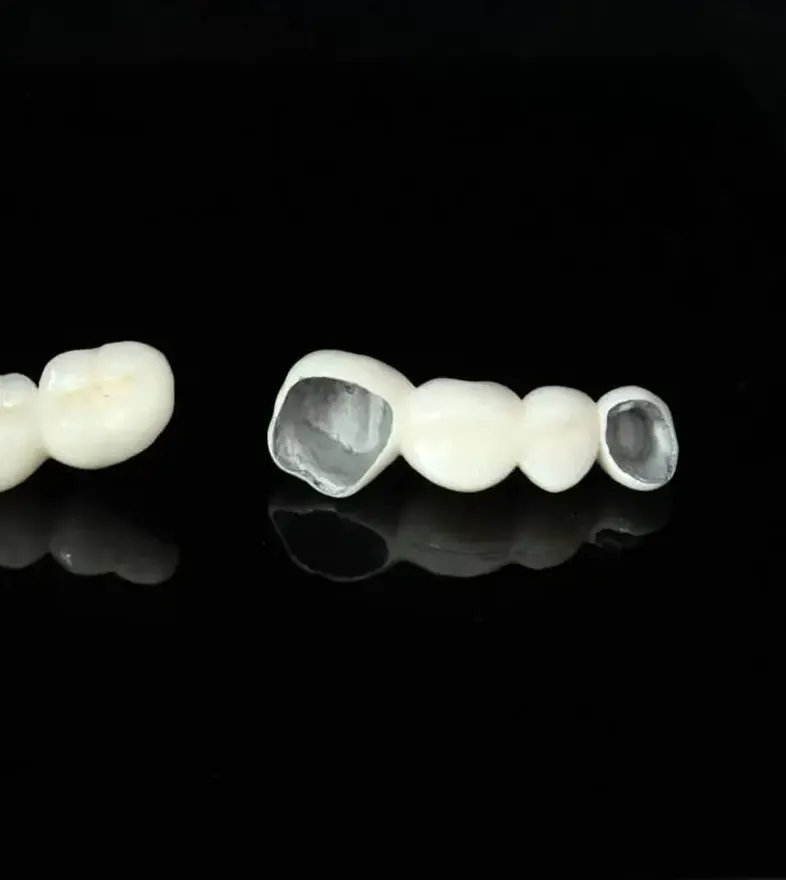 Dental Crowns Dental Crowns