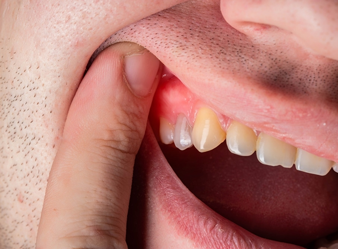 Help Me Figure Out What’s Wrong With My Teeth