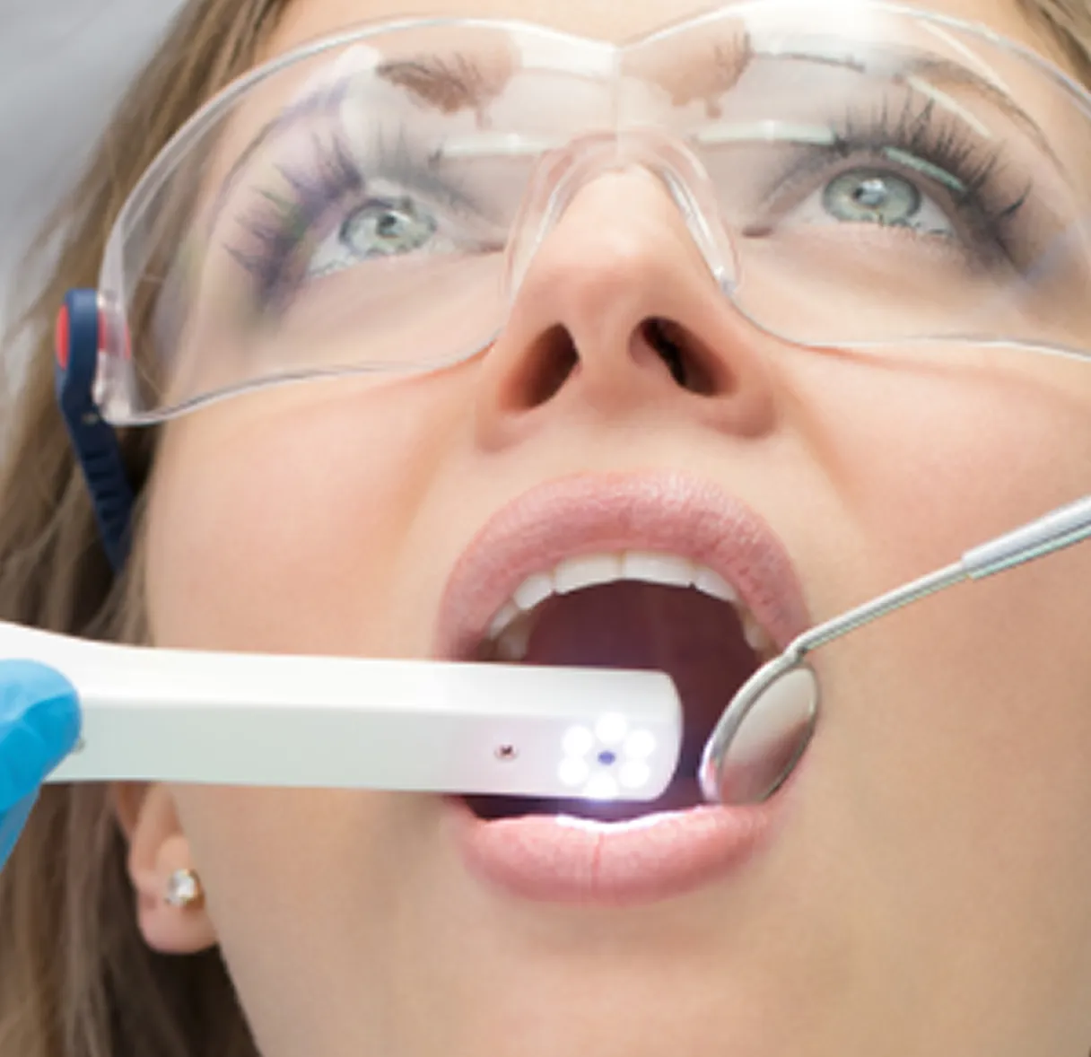 Intraoral Camera Intraoral Camera
