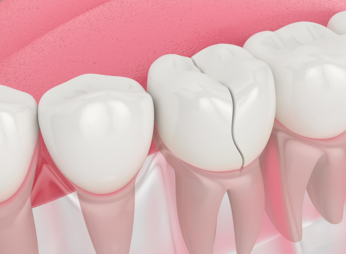 Help Me With Tooth Pain or an Emergency