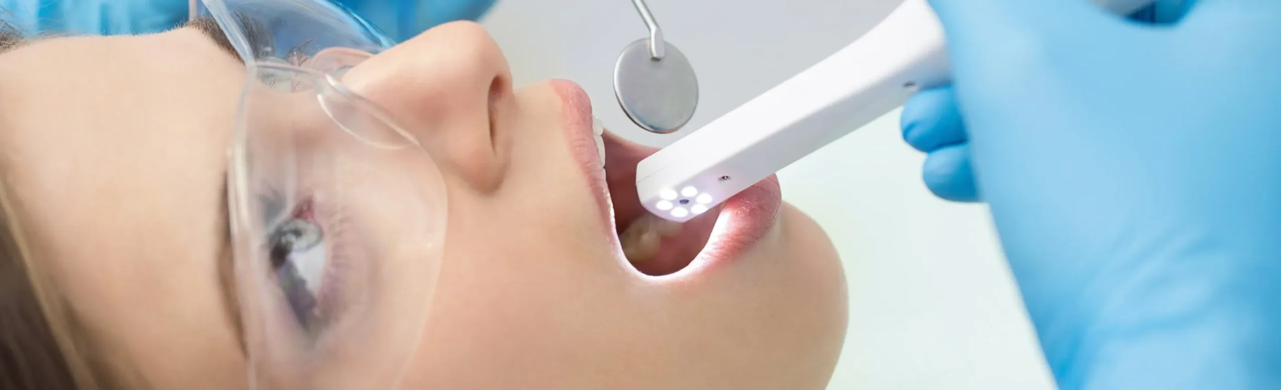 Intraoral Camera Intraoral Camera
