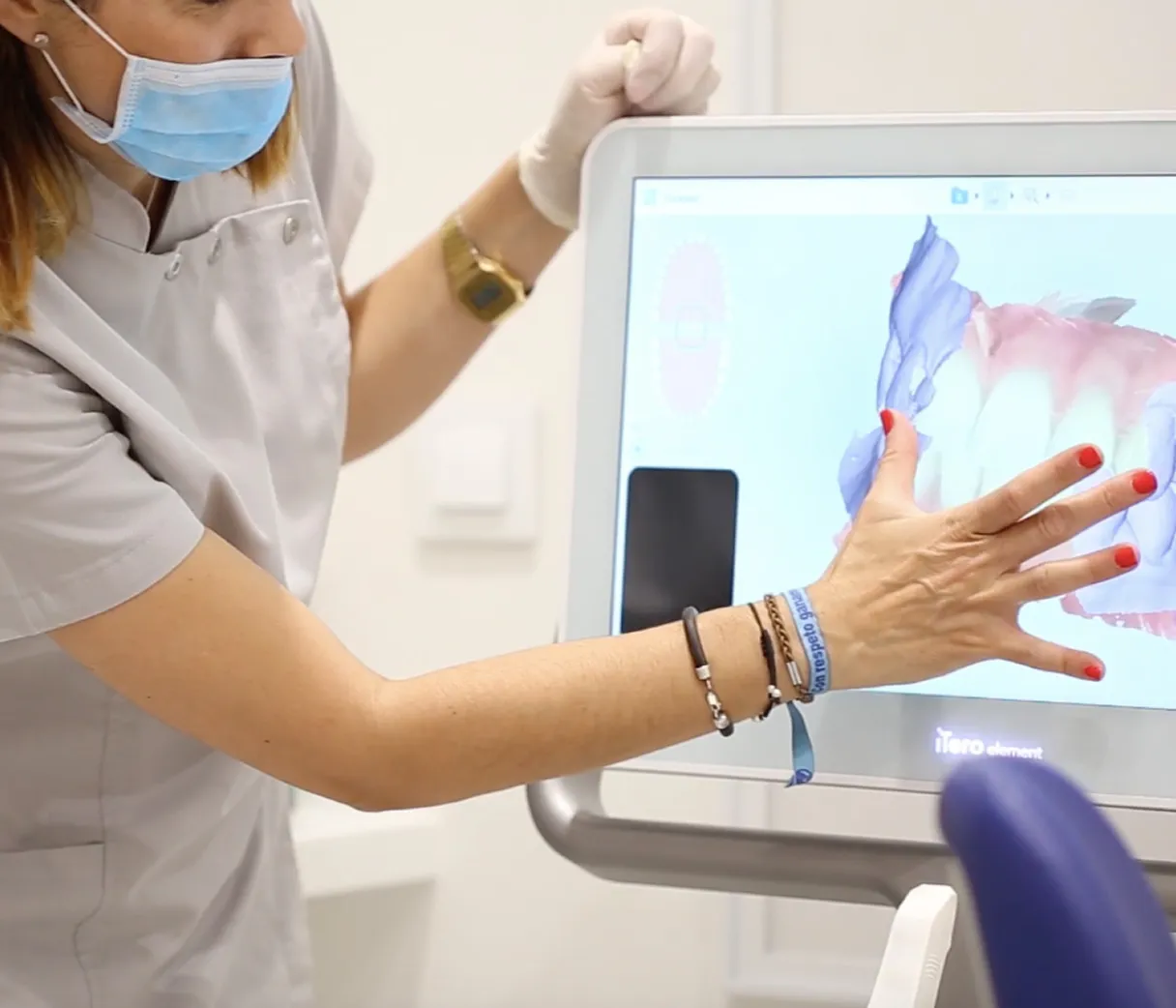 Caries detection devices (iTero, Niri, DIAGNOCat)