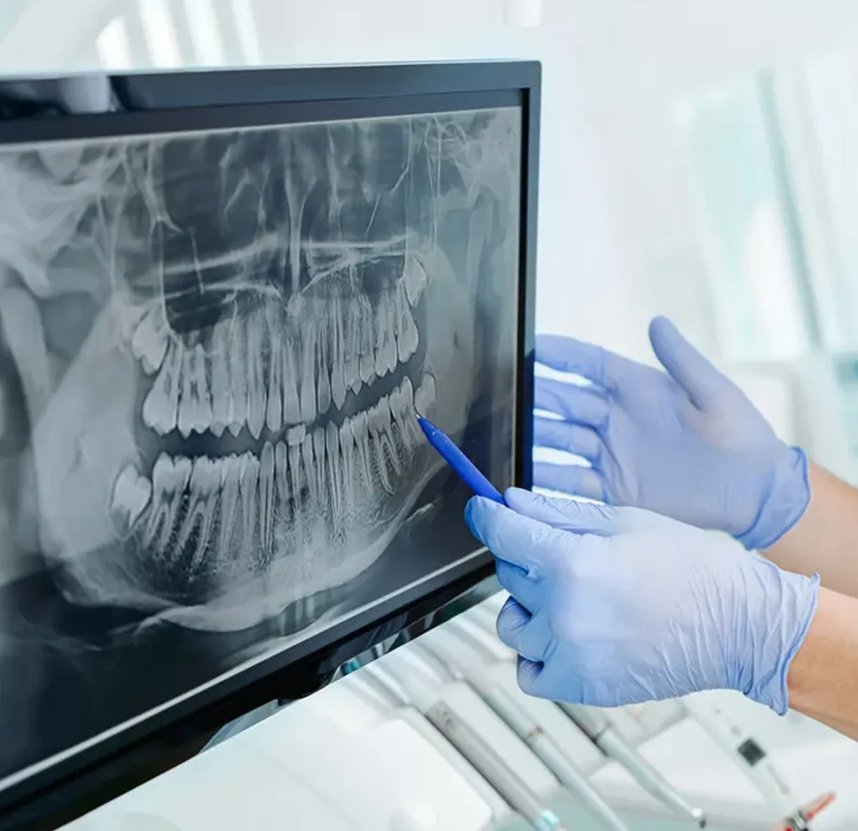 Panoramic X-Ray Unit Panoramic X-Ray Unit