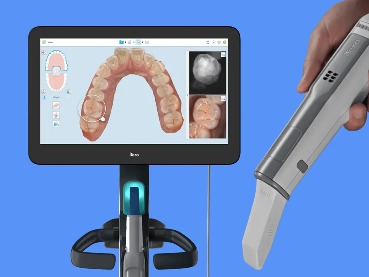 Caries detection devices (iTero, Niri, DIAGNOCat)