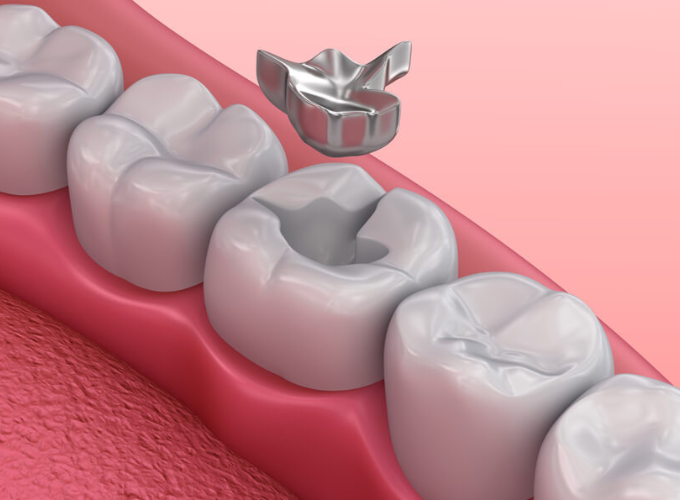 Help Me With Tooth Pain or an Emergency
