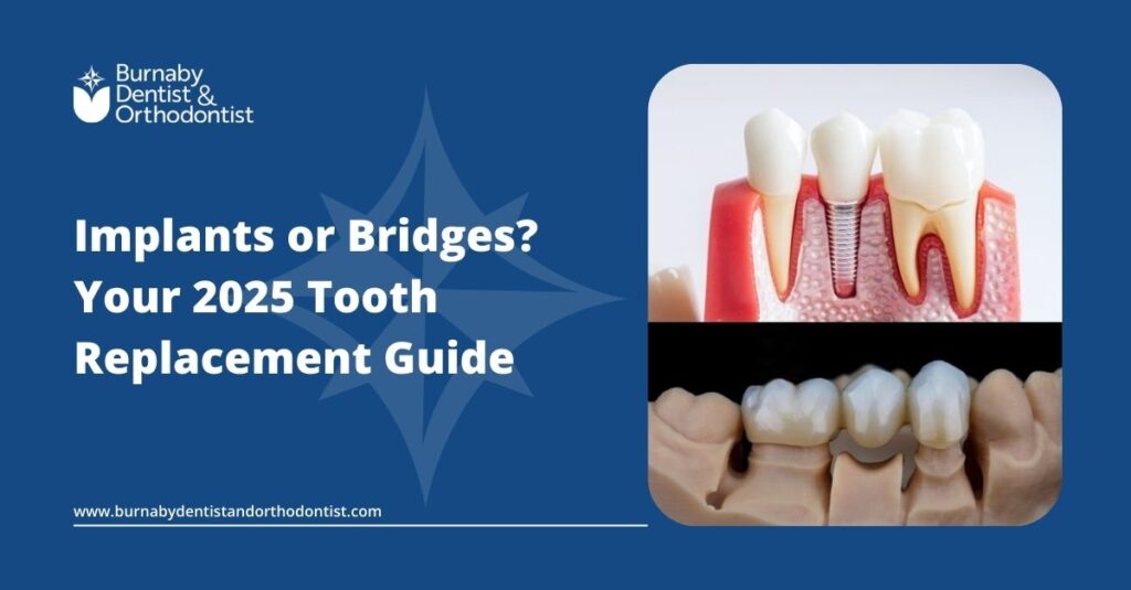 Implants or Bridges? Your 2025 Tooth Replacement Guide