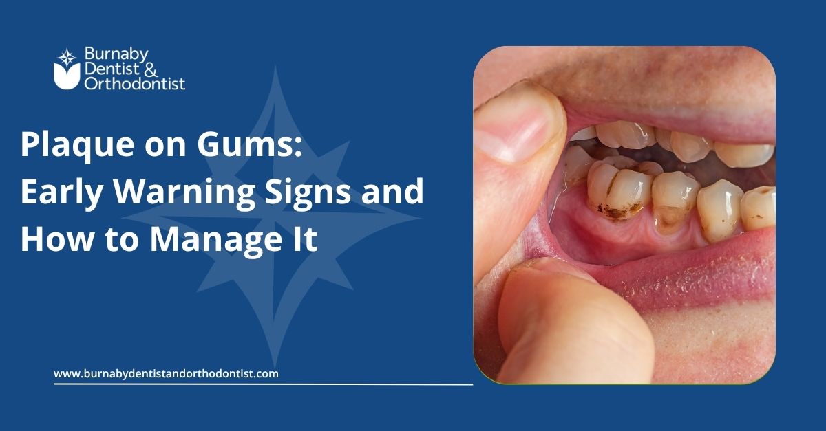 Close-up illustration showing plaque buildup along the gumline
