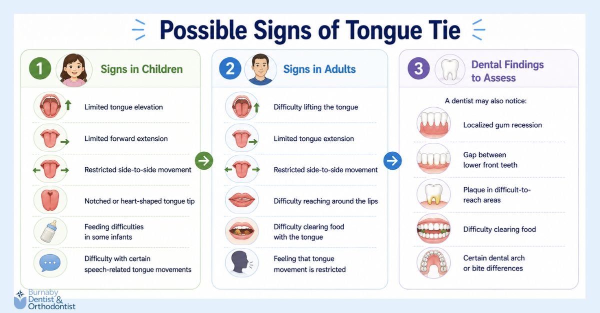  Infographic showing possible signs of tongue tie in children and adults, including restricted tongue movement, feeding or speech-related difficulties, and dental findings such as gum recession, plaque buildup, food-clearing difficulty, and bite differences.