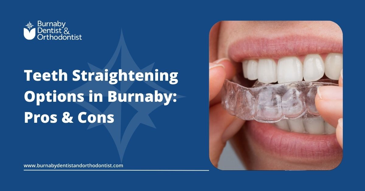 Clear aligner being placed over teeth, representing teeth straightening options