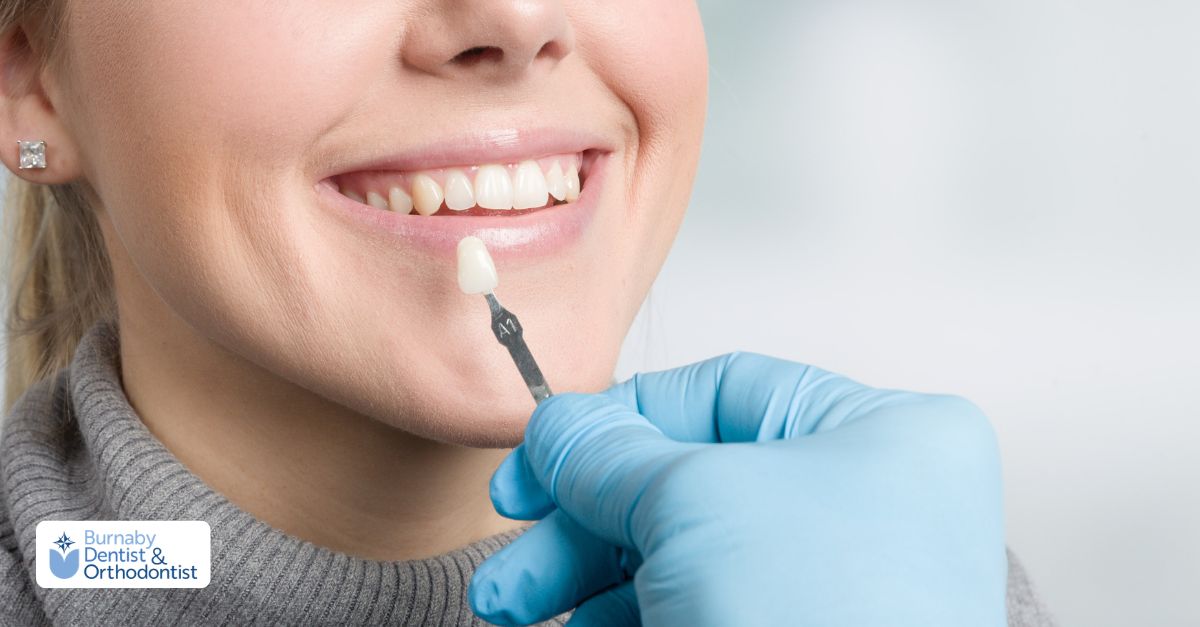 Dentist comparing veneer shade to patient’s teeth, illustrating types of dental veneers.