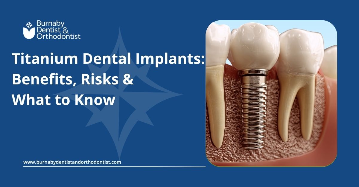Titanium dental implant placed in the jawbone with a natural-looking replacement tooth