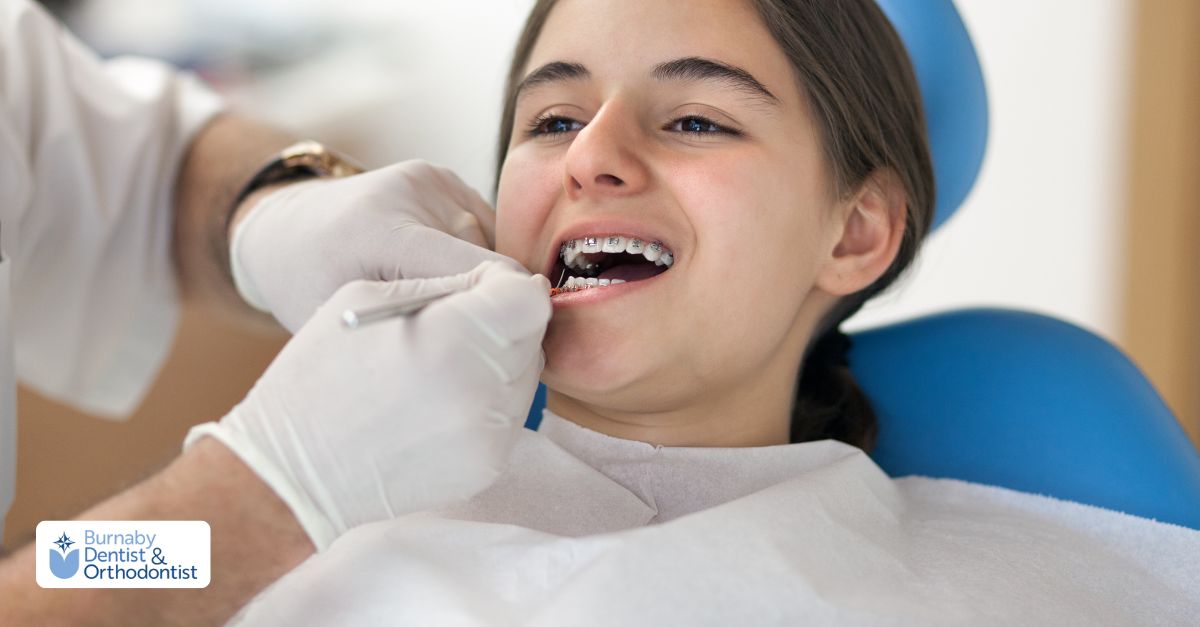 Pros and cons of using traditional metal braces for teeth straightening