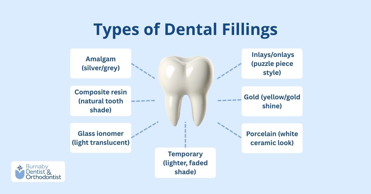 Types of dental fillings: amalgam, composite, glass ionomer, inlays/onlays, gold, porcelain, and temporary.