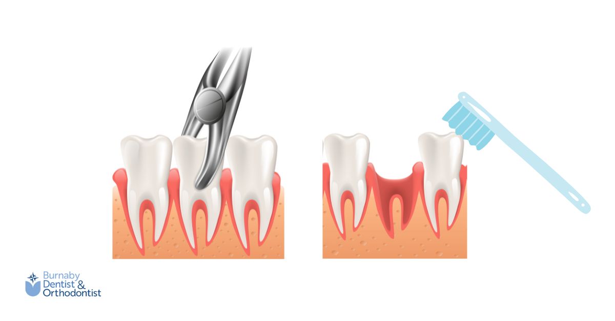 Right Tools to Keep the Area Clean after extraction