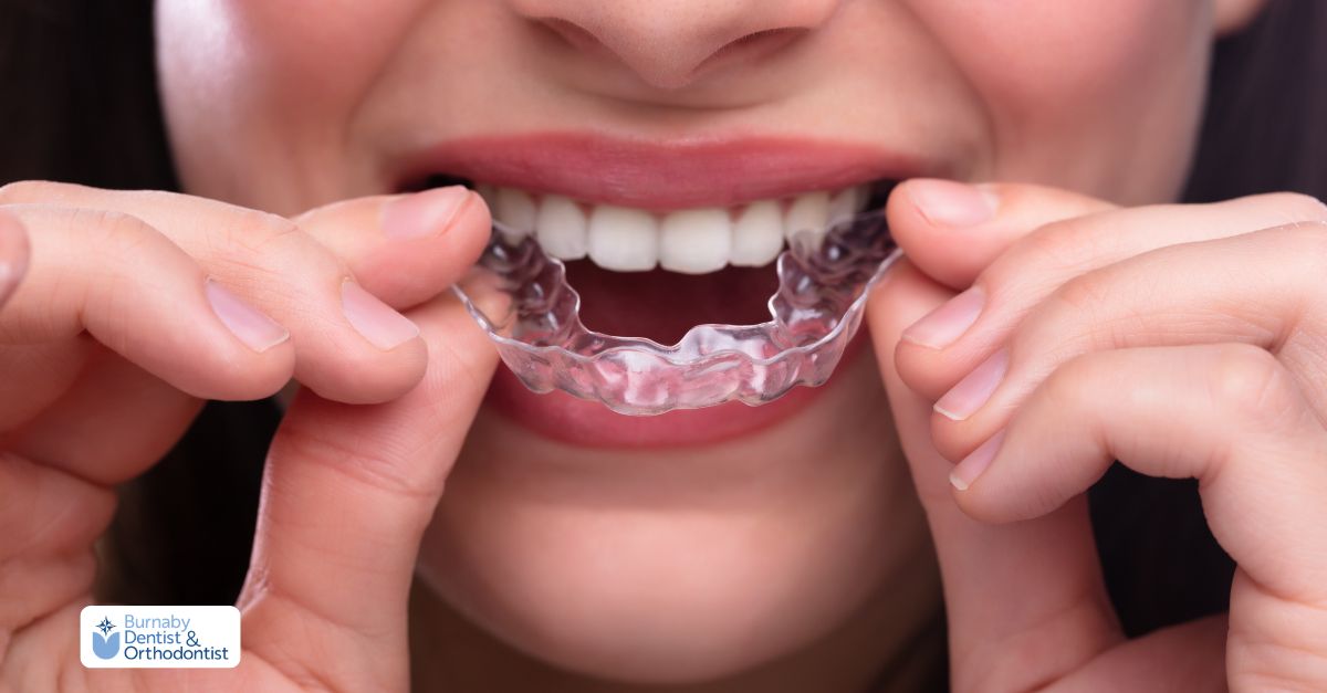 Smiling patient about to place clear aligners over teeth.