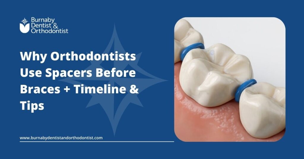 Why Orthodontists Use Spacers Before Braces + Timeline & Tips