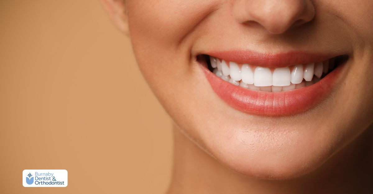 Cosmetic dentistry result showing smooth white porcelain veneers