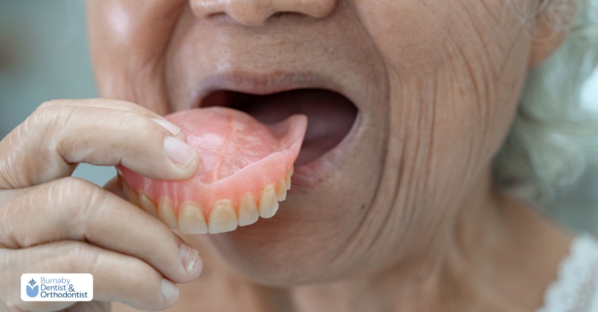 Traditional full dentures resting on a pink gum base, designed to replace missing teeth without dental implants.