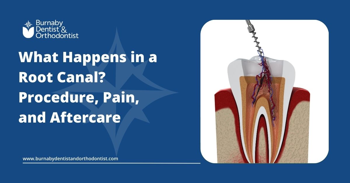Tooth anatomy diagram explaining how a root canal works