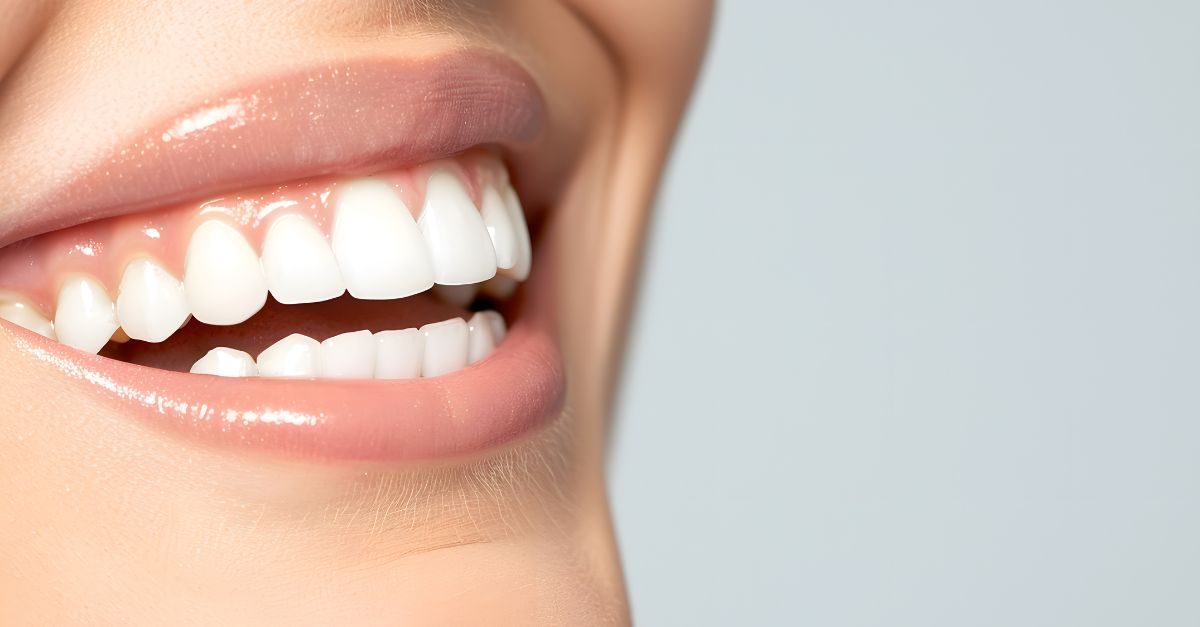  Cosmetic dentistry results showing a bright, natural smile that supports confidence and self-expression.