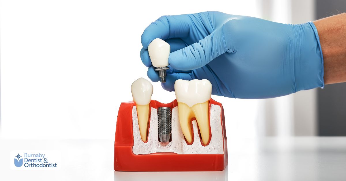 A woman with a dental implant smiles while getting her teeth treated