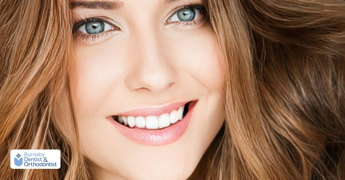 A woman with bright white teeth smiling, showcasing her dental veneers, which are covered by dental insurance.